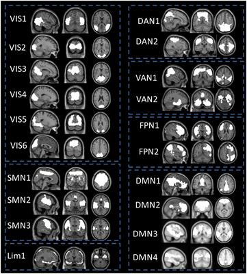 Abnormal static and dynamic functional network connectivity of the whole-brain in children with generalized tonic-clonic seizures